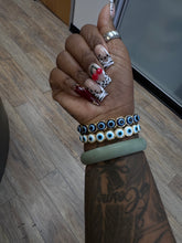 Smile stack brackets
